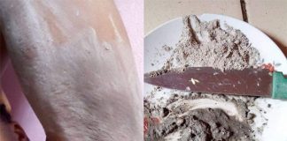 Comment effacer les vergetures sur notre peau