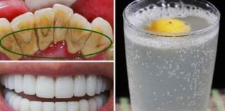 Méthode naturelle pour avoir des dents propres et blanches