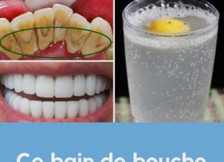 Méthode naturelle pour avoir des dents propres et blanches