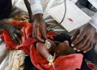 Cameroun : fuite massive des pédiatres vers l’Europe