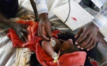 Cameroun : fuite massive des pédiatres vers l’Europe